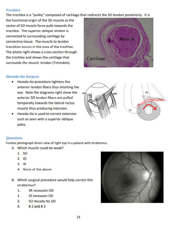 Ophthalmology Book - Wright's Strabismus Review – Made Crazy Easy - Wright  Center